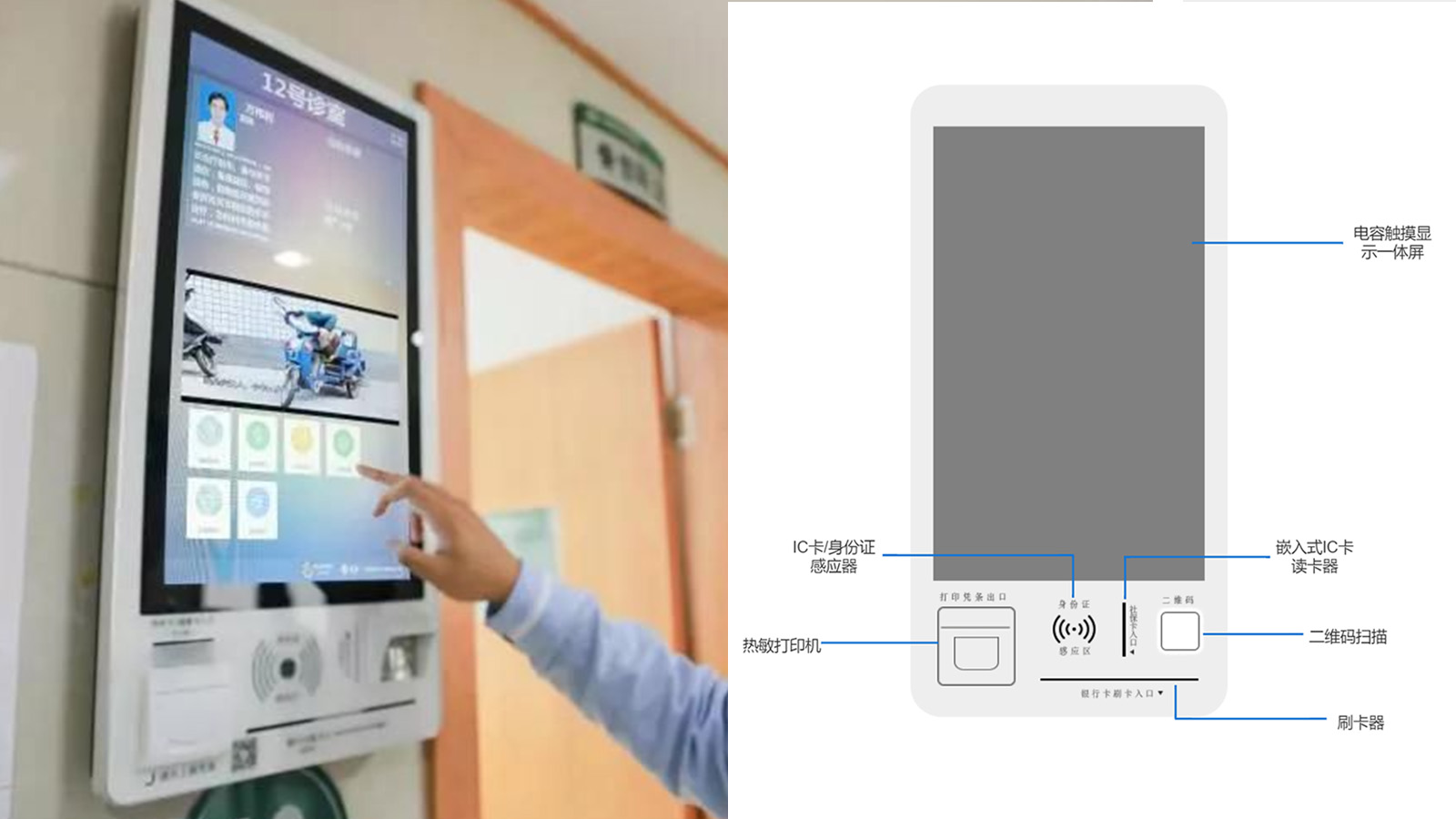 派勤電子AD742A工控主板 | 醫(yī)療設(shè)備領(lǐng)域的智能化解決方案 派勤電子AD742A工控主板 | 醫(yī)療設(shè)備領(lǐng)域的智能化解決方案